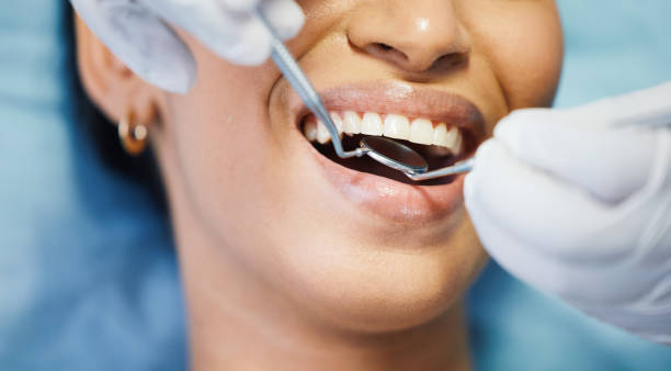 Best Emergency Gum Treatment in Ridgeville, SC